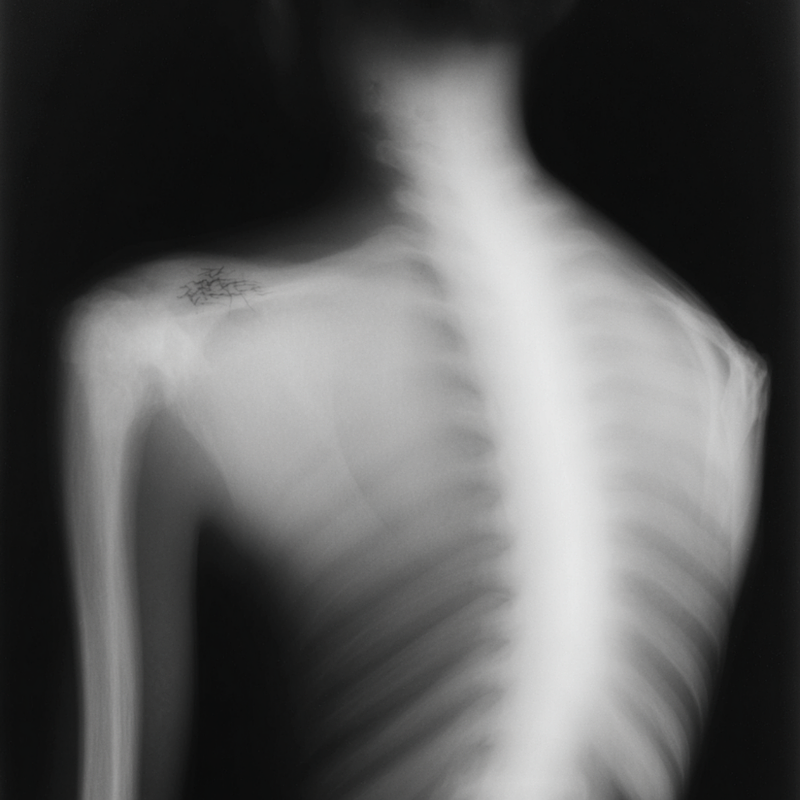 Bone Density Testing During Menopause: Your Essential Guide to Preventing Fractures